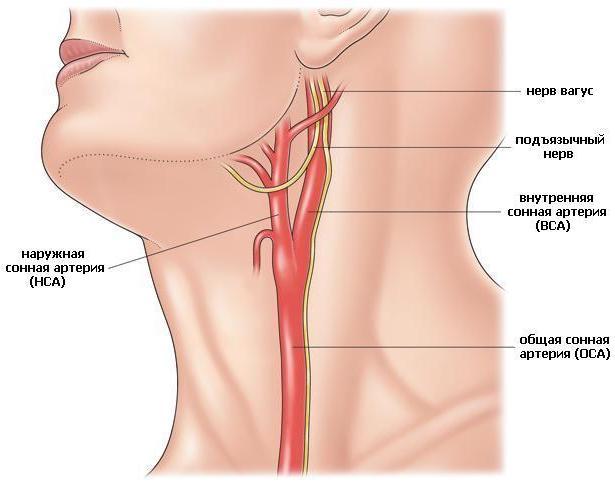 Синдром позвоночной артерии - Vertebra